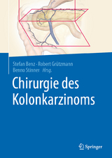 Chirurgie des Kolonkarzinoms - 