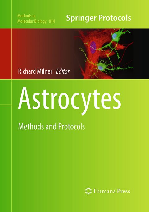 Astrocytes - 