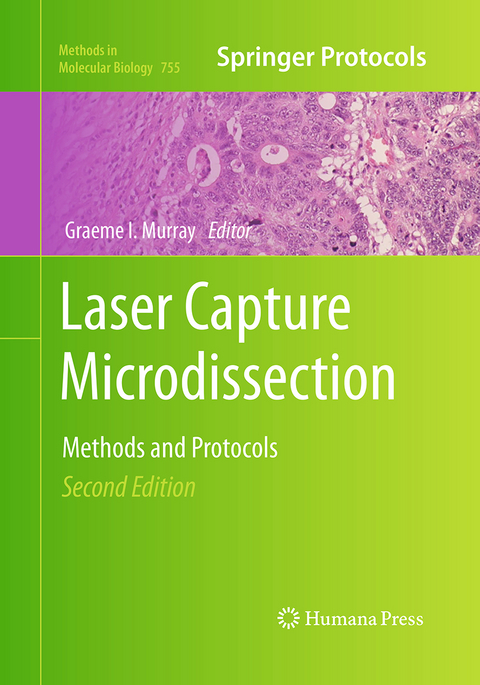 Laser Capture Microdissection - 