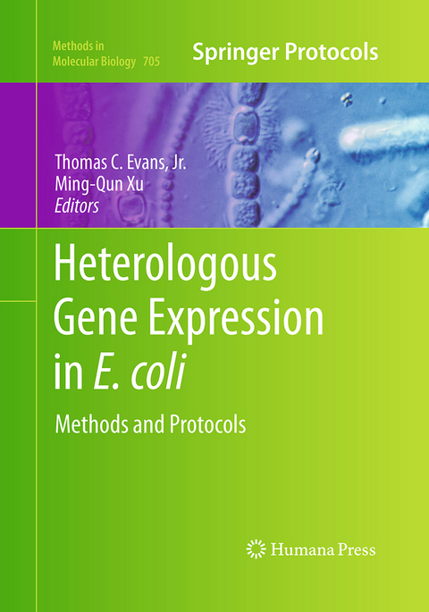 Heterologous Gene Expression in E.coli - 