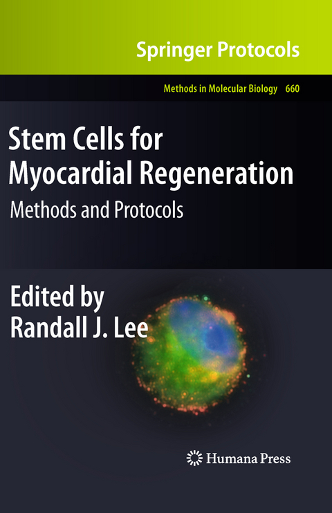 Stem Cells for Myocardial Regeneration - 