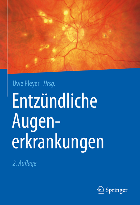 Entzündliche Augenerkrankungen - 