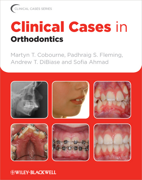 Clinical Cases in Orthodontics -  Sofia Ahmad,  Martyn T. Cobourne,  Andrew T. DiBiase,  Padhraig S. Fleming