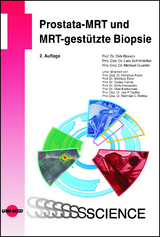 Prostata-MRT und MRT-gestützte Biopsie - Blondin, Dirk; Schimmöller, Lars; Quentin, Michael