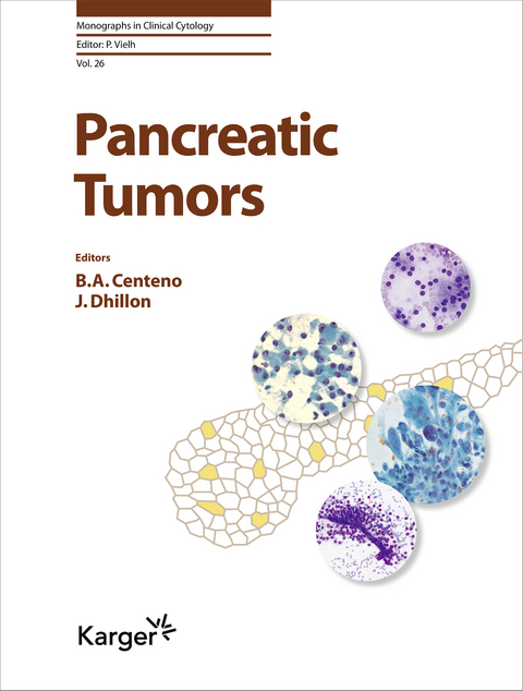 Pancreatic Tumors