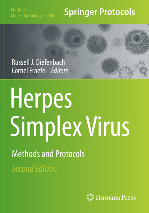 Herpes Simplex Virus - 