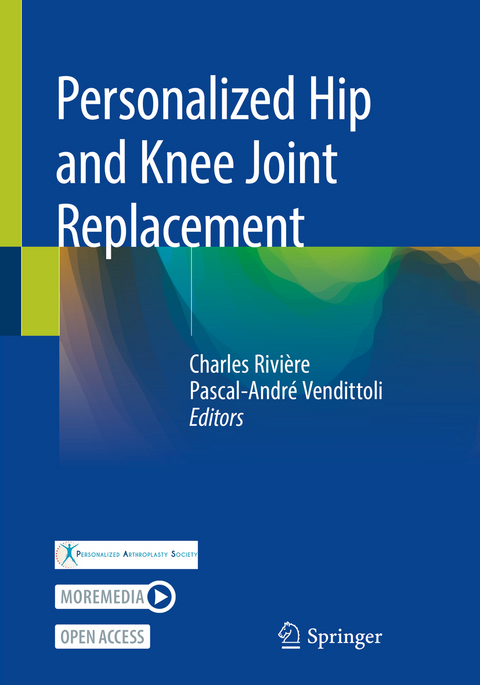 Personalized Hip and Knee Joint Replacement - 