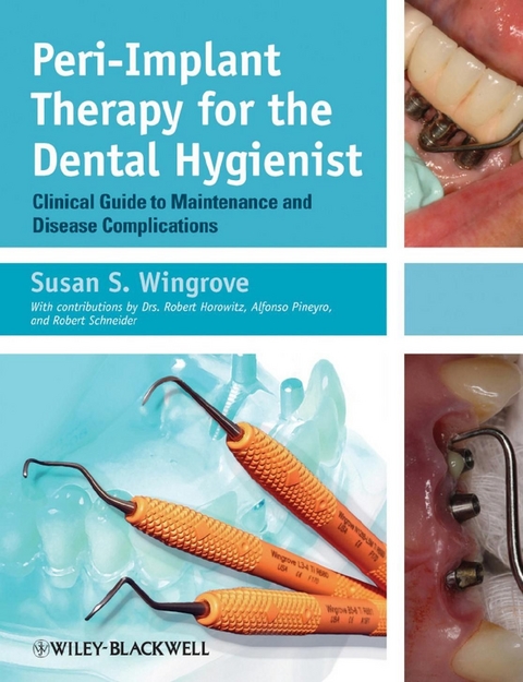 Peri-Implant Therapy for the Dental Hygienist -  Susan S. Wingrove