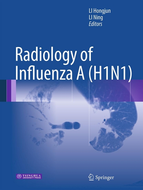 Radiology of Influenza A (H1N1) - 