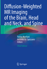 Diffusion-Weighted MR Imaging of the Brain, Head and Neck, and Spine - Moritani, Toshio; Capizzano, Aristides A.