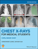 Chest X-Rays for Medical Students - Clarke, Christopher; Dux, Anthony