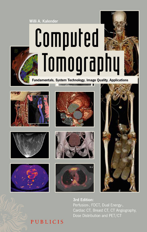 Computed Tomography -  Willi A. Kalender