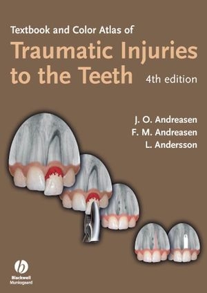 Textbook and Color Atlas of Traumatic Injuries to the Teeth - 