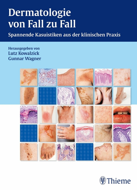 Dermatologie von Fall zu Fall - 