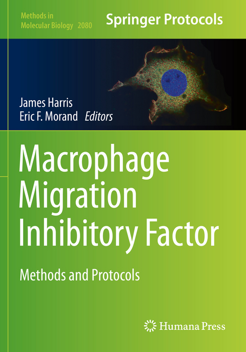 Macrophage Migration Inhibitory Factor - 