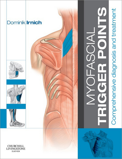 Myofascial Trigger Points -  Dominik Irnich