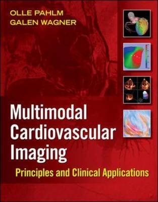 Multimodal Cardiovascular Imaging: Principles and Clinical Applications -  Olle Pahlm,  Galen S. Wagner