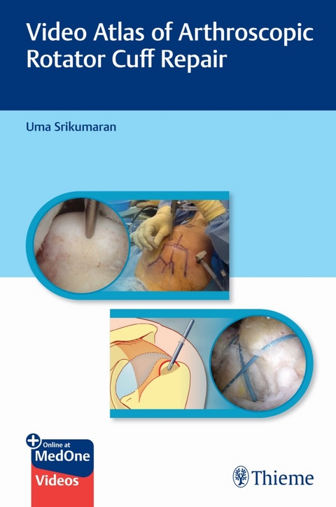 Video Atlas of Arthroscopic Rotator Cuff Repair - Uma Srikumaran