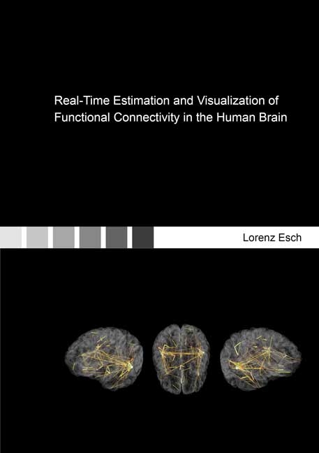 Real-Time Estimation and Visualization of Functional Connectivity in the Human Brain - Lorenz Esch