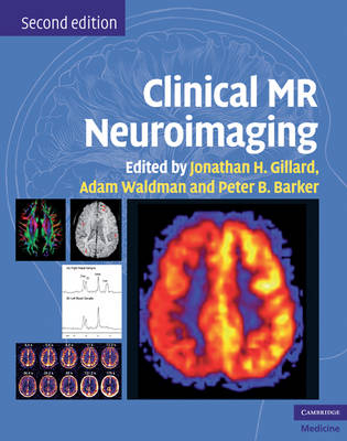 Clinical MR Neuroimaging - 