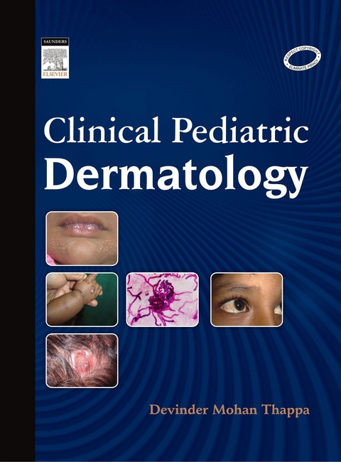 Clinical Pediatric Dermatology - E-Book -  Devinder Mohan Thappa