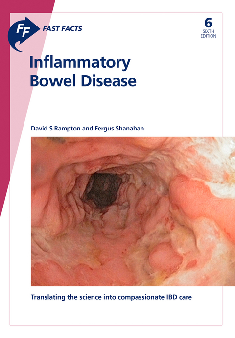 Fast Facts: Inflammatory Bowel Disease - David S. Rampton, Fergus Shanahan