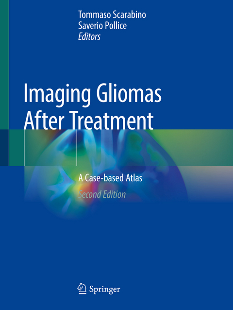 Imaging Gliomas After Treatment - 