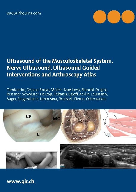 Ultrasound of the Musculoskeletal System, Nerve Ultrasound, Ultrasound Guided Interventions and Arthroscopy Atlas - Giorgio Tamborrini, Christian Dejaco George A.W. Bruyn, Lisa Reissner Andreas Schweizer, Andreas A. M. Müller Sebastian A. Müller, Richard F. Herzog Floreana Kebaish, Christian Egloff Yves Acklin, André Leumann Michael Sager, Andreas Siegenthaler David Lorenzana, Laure Brulhart Amara Pieren