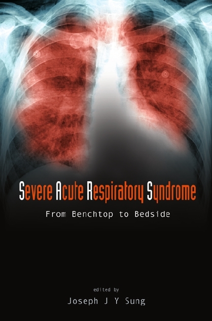 SEVERE ACUTE RESPIRATORY SYNDROME - Joseph Jao Yiu Sung