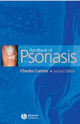 Handbook of Psoriasis - Charles Camisa