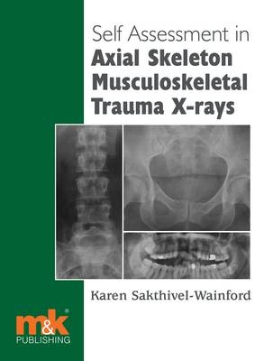 Self-assessment in Axial Musculoskeletal Trauma X-rays -  Karen Sakthivel-Wainford