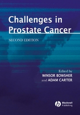 Challenges in Prostate Cancer - 