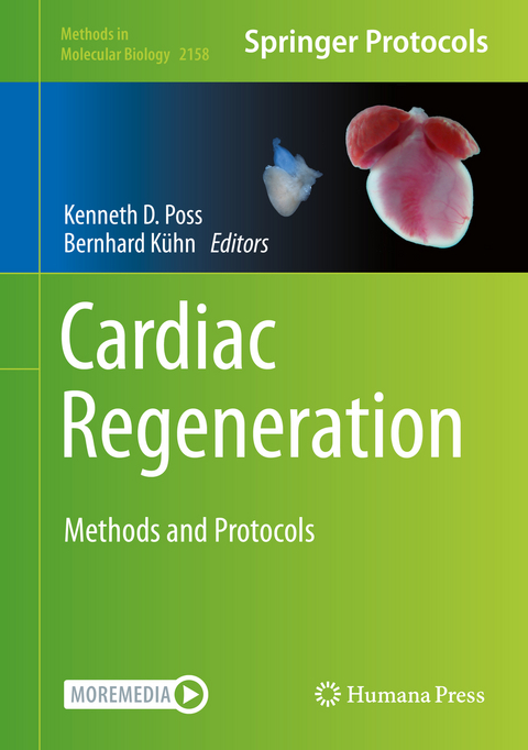 Cardiac Regeneration - 