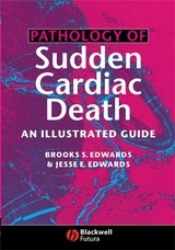 Pathology of Sudden Cardiac Death - Brooks S. Edwards, Jesse E. Edwards