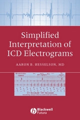 Simplified Interpretation of ICD Electrograms -  Aaron B. Hesselson