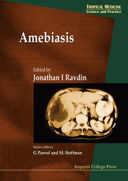 Amebiasis - 