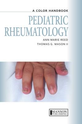 Pediatric Rheumatology -  Thomas Mason,  Anne Marie Reed