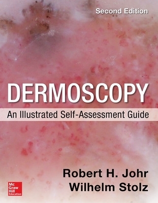 Dermoscopy: An Illustrated Self-Assessment Guide, 2/e - Robert Johr, Wilhelm Stolz