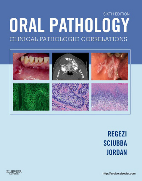 Oral Pathology -  Joseph A. Regezi,  James J. Sciubba,  Richard C. K. Jordan