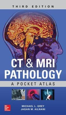 CT & MRI Pathology: A Pocket Atlas, Third Edition - Michael Grey, Jagan Ailinani