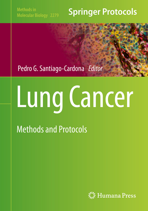 Lung Cancer - 