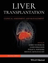 Liver Transplantation - Neuberger, James; Ferguson, James; Newsome, Philip N.; Lucey, Michael R.