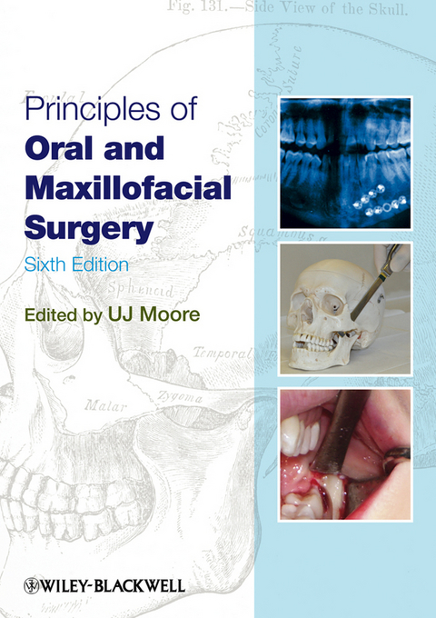 Principles of Oral and Maxillofacial Surgery - U. J. Moore