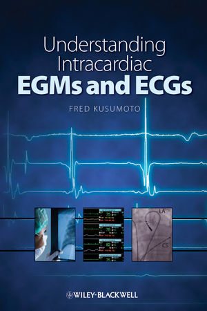 Understanding Intracardiac EGMs and ECGs - Fred Kusumoto