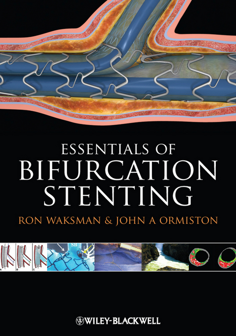 Bifurcation Stenting - Ron Waksman, John Ormiston