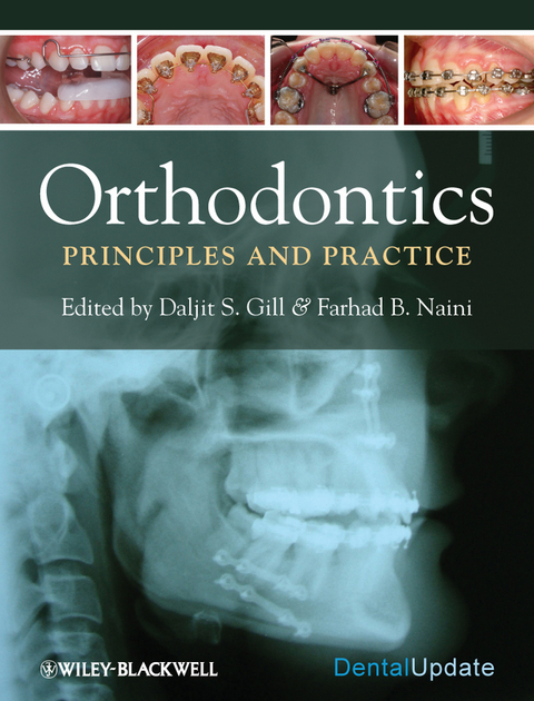 Orthodontics -  Daljit S. Gill,  Farhad B. Naini