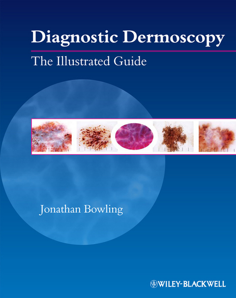 Diagnostic Dermoscopy - Jonathan Bowling