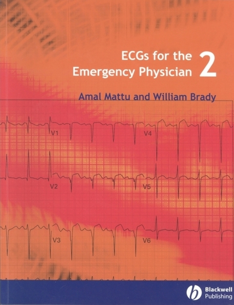 ECGs for the Emergency Physician 2 - Amal Mattu, William J. Brady