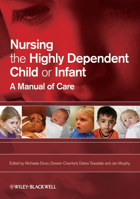 Nursing the Highly Dependent Child or Infant - 