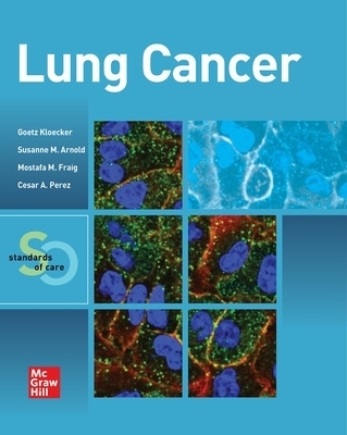 Lung Cancer:  Standards of Care - Goetz Kloecker, Mostafa Fraig, Susanne M. Arnold, Cesar A. Perez